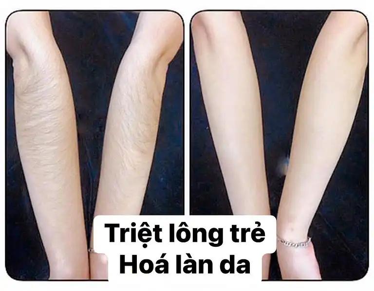 Hình ảnh quyen-revival-beauty-2