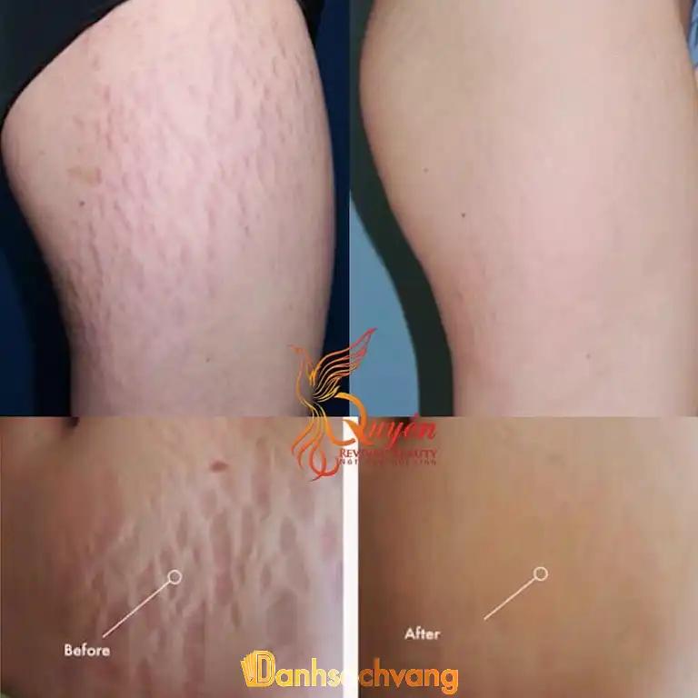 Hình ảnh quyen-revival-beauty-2