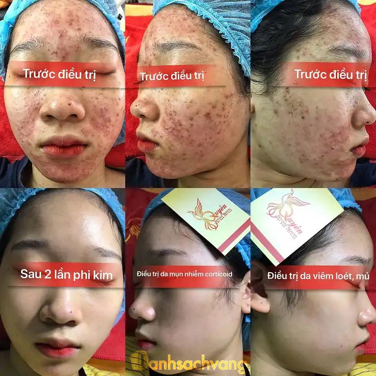 Hình ảnh quyen-revival-beauty-4