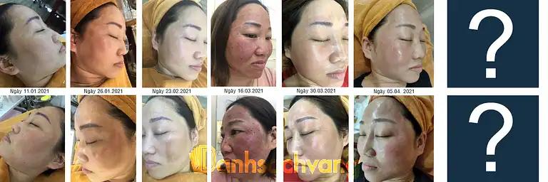 Hình ảnh mari-beauty-spa-pho-vac-thanh-oai-1