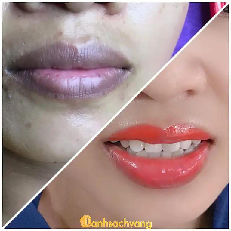 Hình ảnh spa-thao-uyen-188-nui-doi-soc-son-4