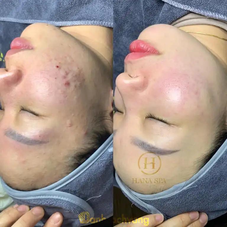 Hình ảnh hana-beauty-spa-119-chi-quan-thach-that-4