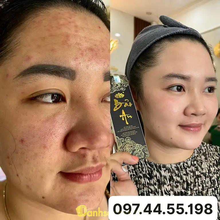 Hình ảnh linh-doan-beauty-spa-xom-cho-thanh-oai-4