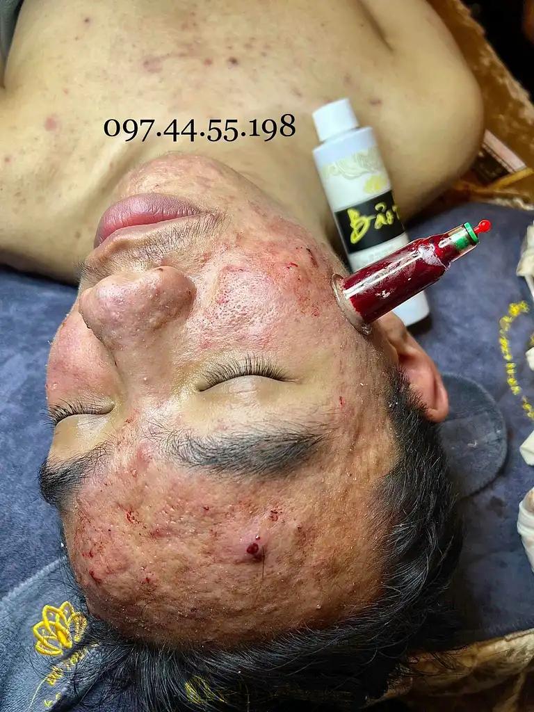 Hình ảnh linh-doan-beauty-spa-xom-cho-thanh-oai-1