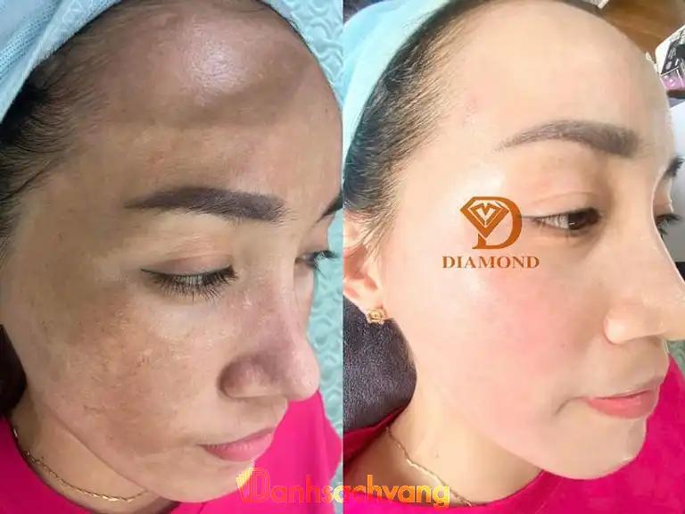 Hình ảnh diamond-spa-academy-dg04-phu-quoc-quoc-oai-3