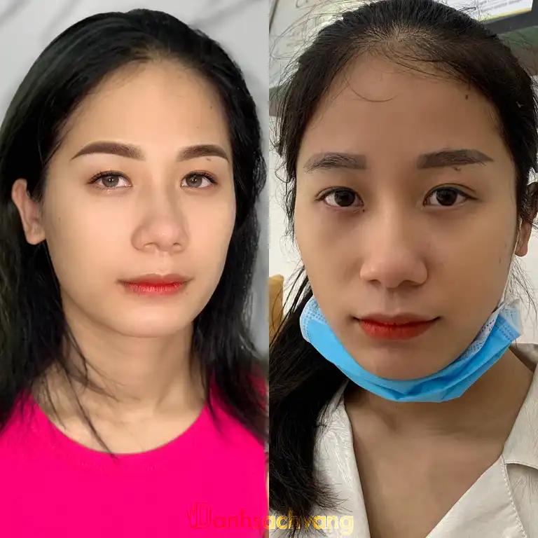 Hình ảnh spa-linh-nguyen-dong-son-quoc-oai-2