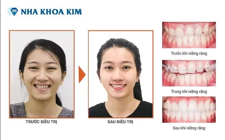 Hình ảnh nha-khoa-kim-162a-ton-duc-thang-dong-da-2
