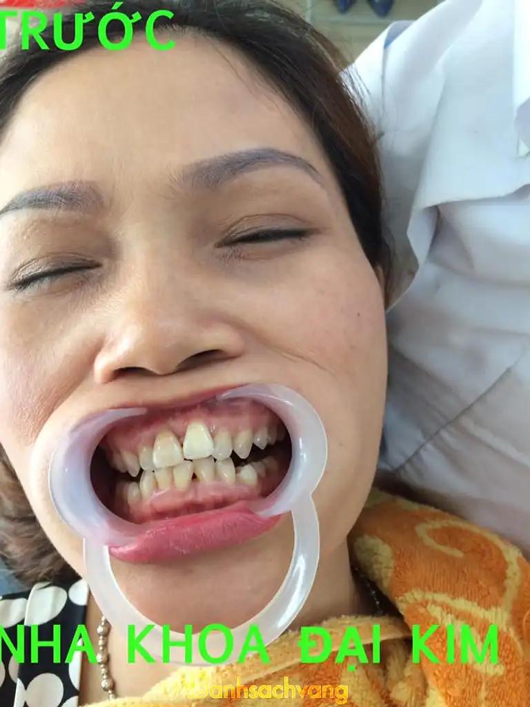Hình ảnh nha-khoa-dai-kim-19b5-nguyen-canh-di-hoang-mai-2