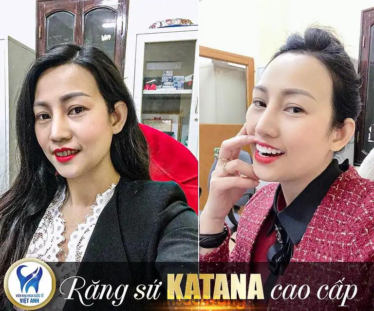 Hình ảnh nha-khoa-viet-anh-6259-xa-dan-dong-da-5