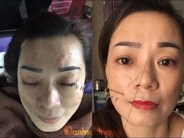 Hình ảnh Ánh Nguyệt Spa & Phun xăm: 81 Phố Ga, Phú Xuyên
