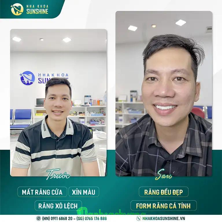 Hình ảnh nha-khoa-sunshine-488-xa-dan-dong-da-3