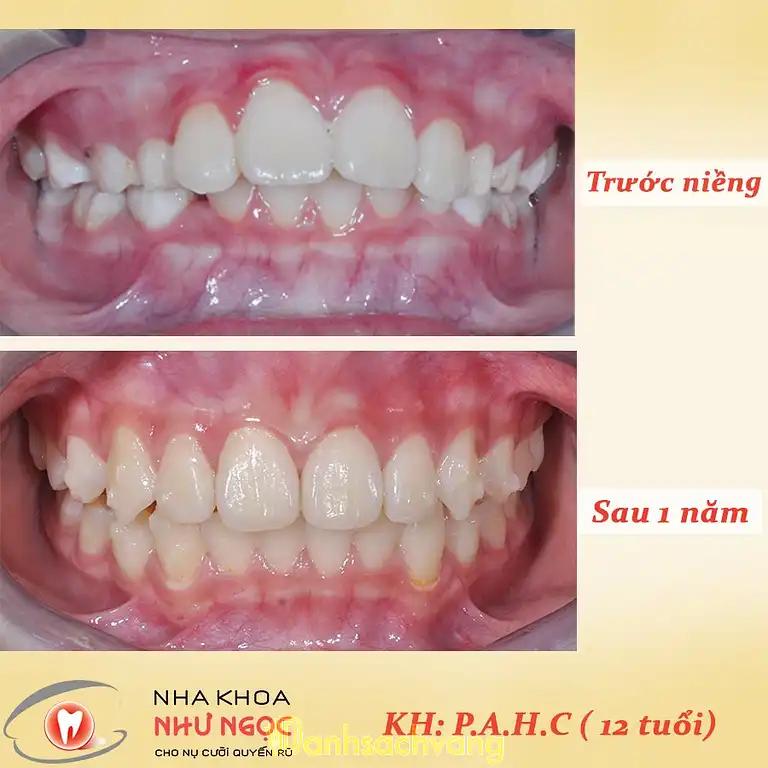Hình ảnh nha-khoa-nhu-ngoc-21-tran-quang-dieu-dong-da-2