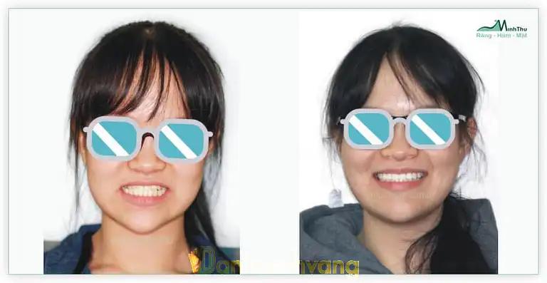 Hình ảnh Nha khoa Minh Thu cs1: 92 Hoàng Ngân, Cầu Giấy