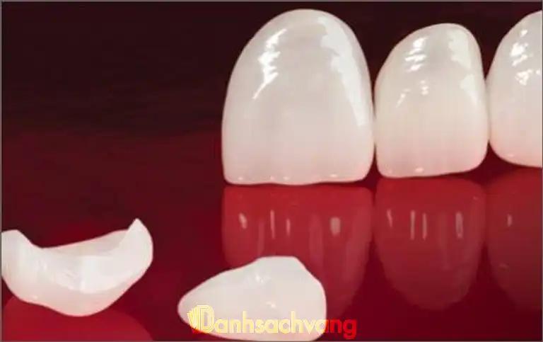 Hình ảnh Nha khoa Bảo Minh: 163 Trung Kính, Cầu Giấy