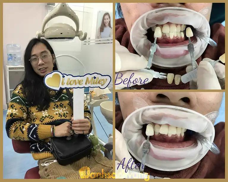 Hình ảnh Miley Dental: 65B Tô Hiến Thành, Hai Bà Trưng