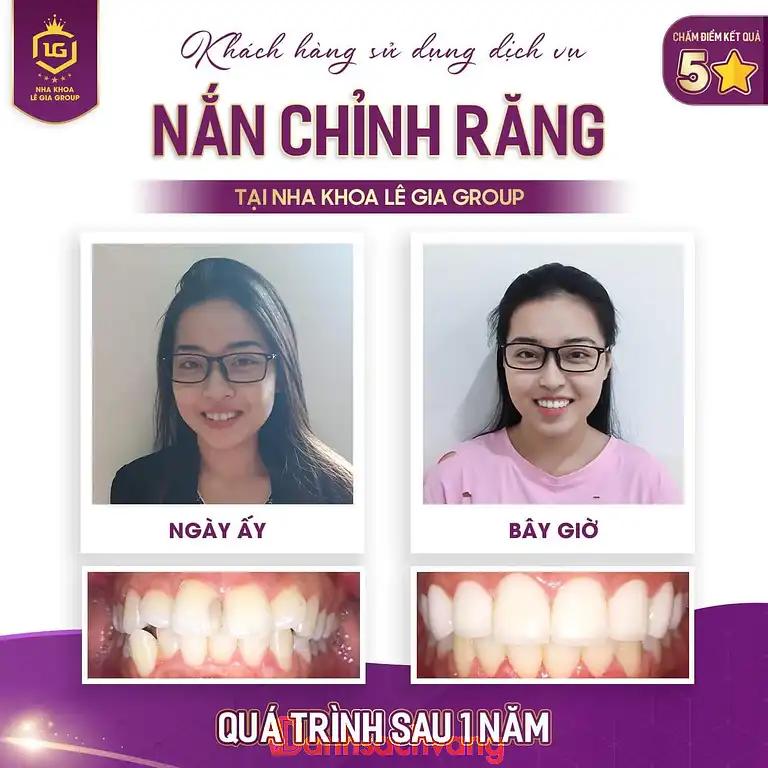 Hình ảnh nha-khoa-le-gia-group-1196-duong-lang-dong-da-4