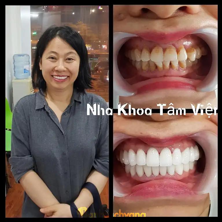Hình ảnh nha-khoa-tam-viet-450-tay-son-dong-da-3