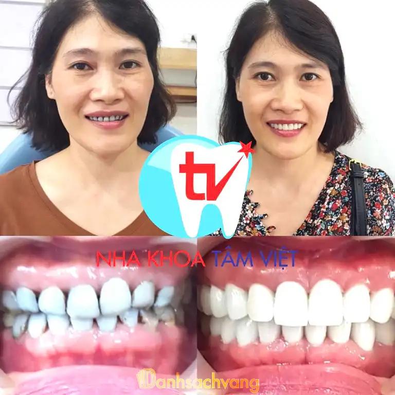 Hình ảnh nha-khoa-tam-viet-450-tay-son-dong-da-5