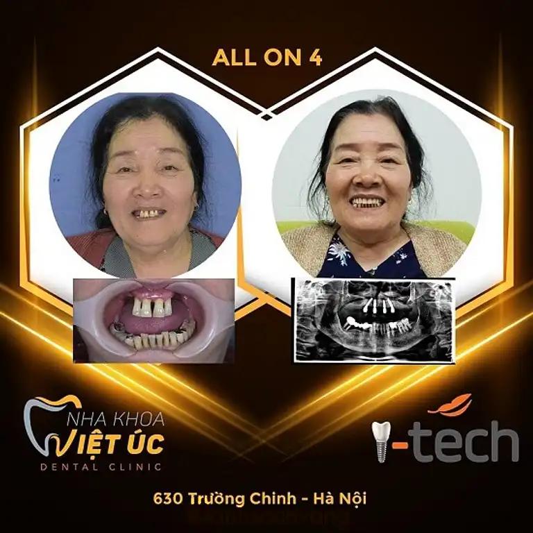 Hình ảnh nha-khoa-viet-uc-630-truong-chinh-dong-da-2