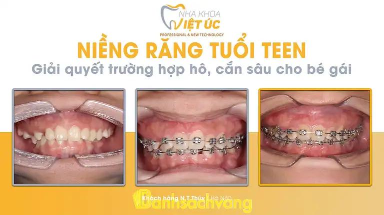 Hình ảnh nha-khoa-viet-uc-630-truong-chinh-dong-da-4