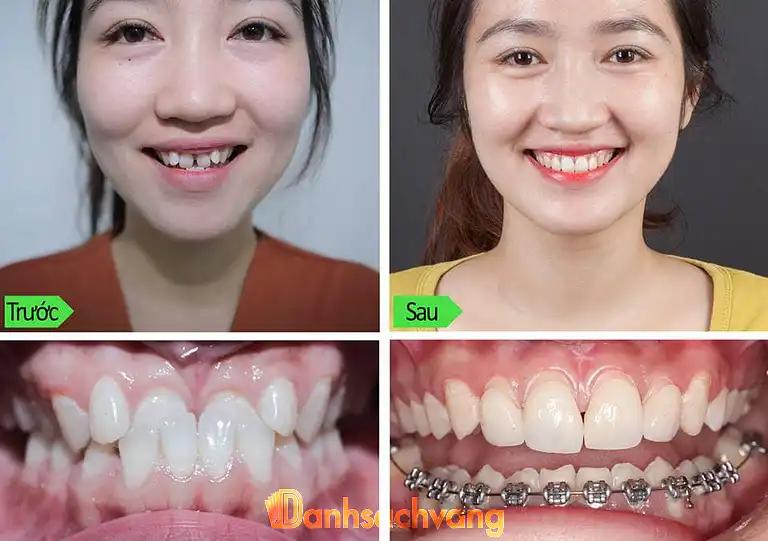Hình ảnh ductoan-dentist-1928a-thai-thinh-dong-da-5
