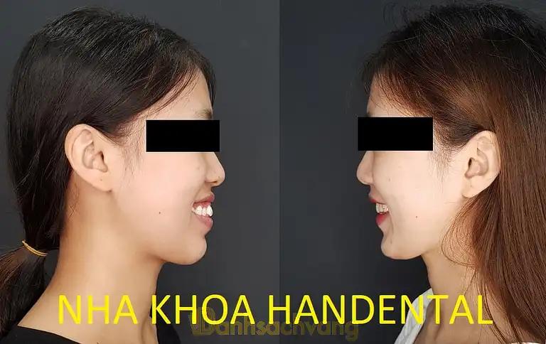 Hình ảnh nha-khoa-han-dental-1