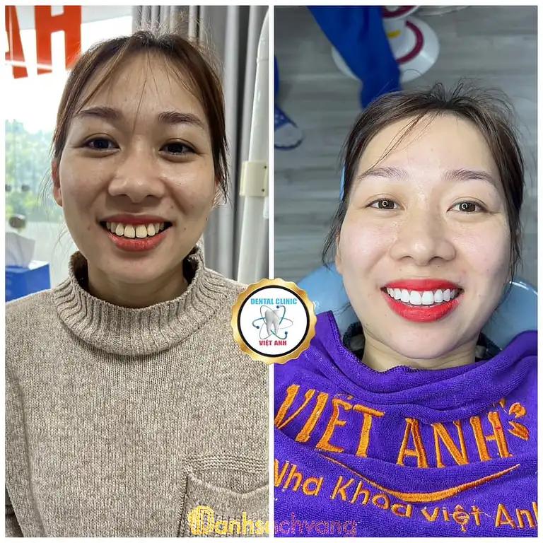 Hình ảnh nha-khoa-viet-anh-191-xa-la-ha-dong-4