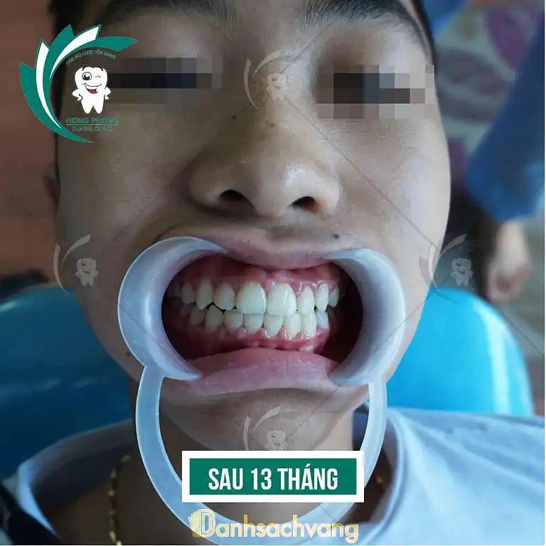 Hình ảnh nha-khoa-hong-phong-167-ho-tung-mau-nam-tu-liem-2