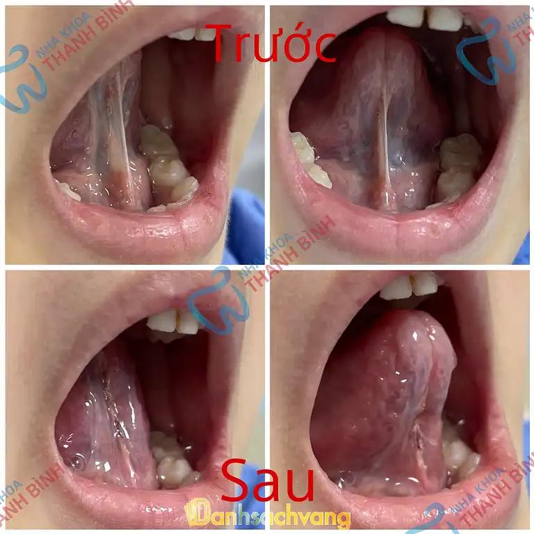 Hình ảnh nha-khoa-thanh-binh-52-dai-an-ha-dong-5