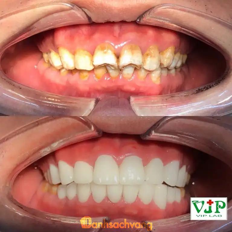 Hình ảnh Nha khoa VIPLAB: 35 Nguyễn Ngọc Vũ, Cầu Giấy
