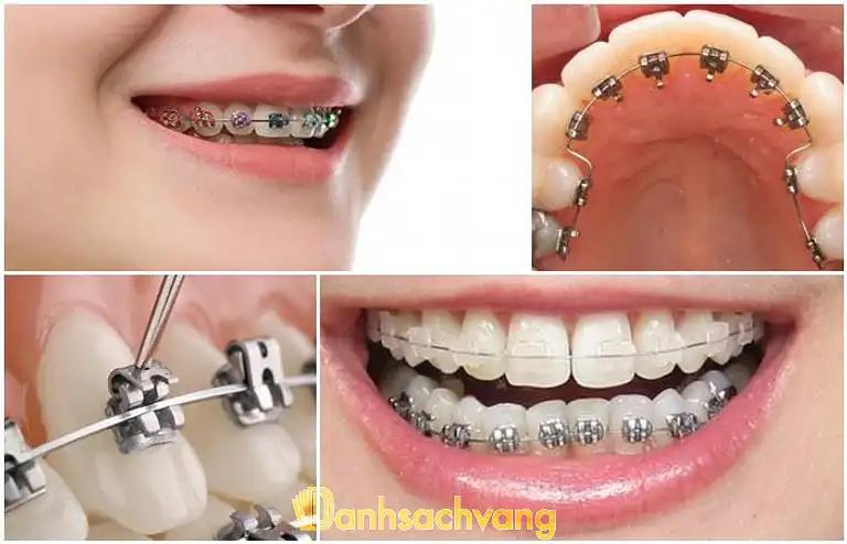 Hình ảnh nha-khoa-hoan-my-56634-kim-giang-thanh-tri-4