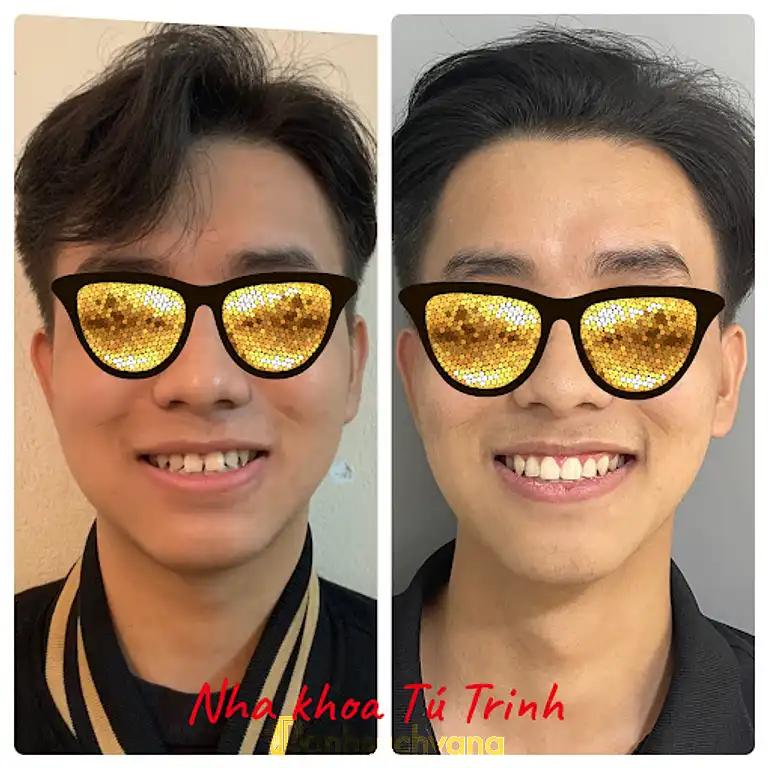 Hình ảnh nha-khoa-tu-trinh-57-ql3-soc-son-1