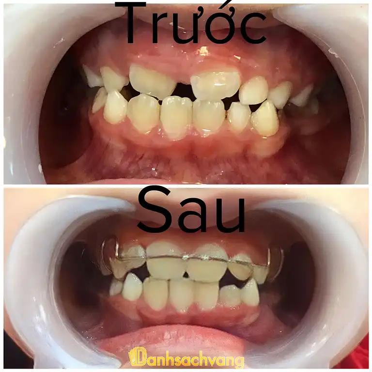 Hình ảnh nha-khoa-sunny-smile-khu-dich-vu-an-tho-hoai-duc-2