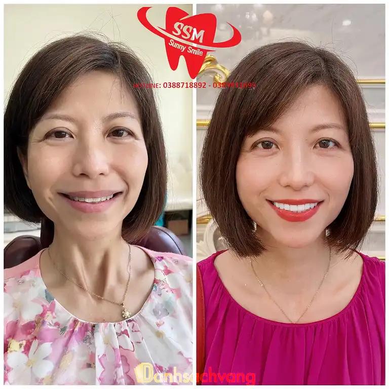 Hình ảnh nha-khoa-sunny-smile-khu-dich-vu-an-tho-hoai-duc-2