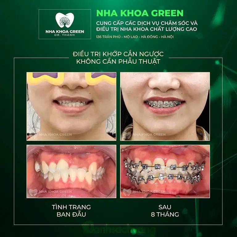 Hình ảnh nha-khoa-green-dr-thanh-136-tran-phu-ha-dong-5