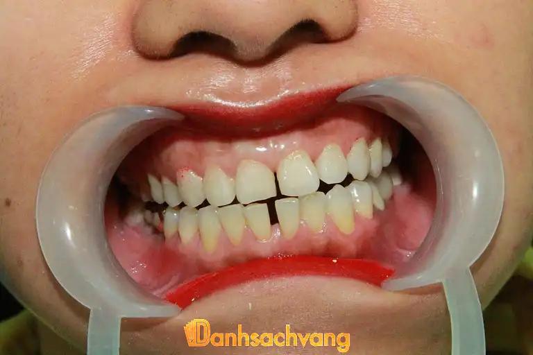Hình ảnh nha-khoa-thach-that-83-chi-quan-thach-that-1