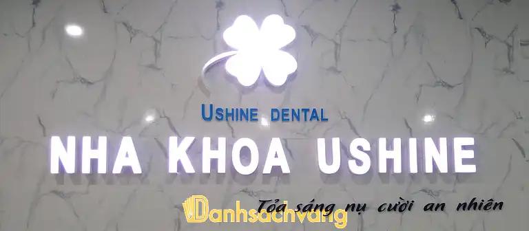 Hình ảnh nha-khoa-ushine-khu-bo-ho-me-linh-1