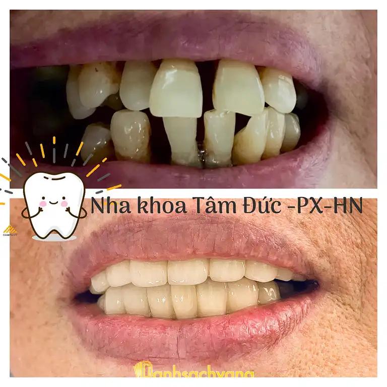 Hình ảnh nha-khoa-tam-duc-son-ha-phu-xuyen-5