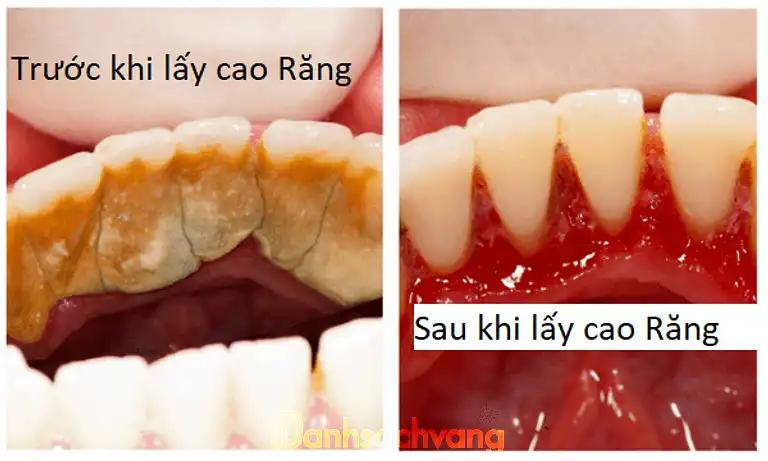 Hình ảnh nha-khoa-duong-nhan-thon-1-me-linh-5