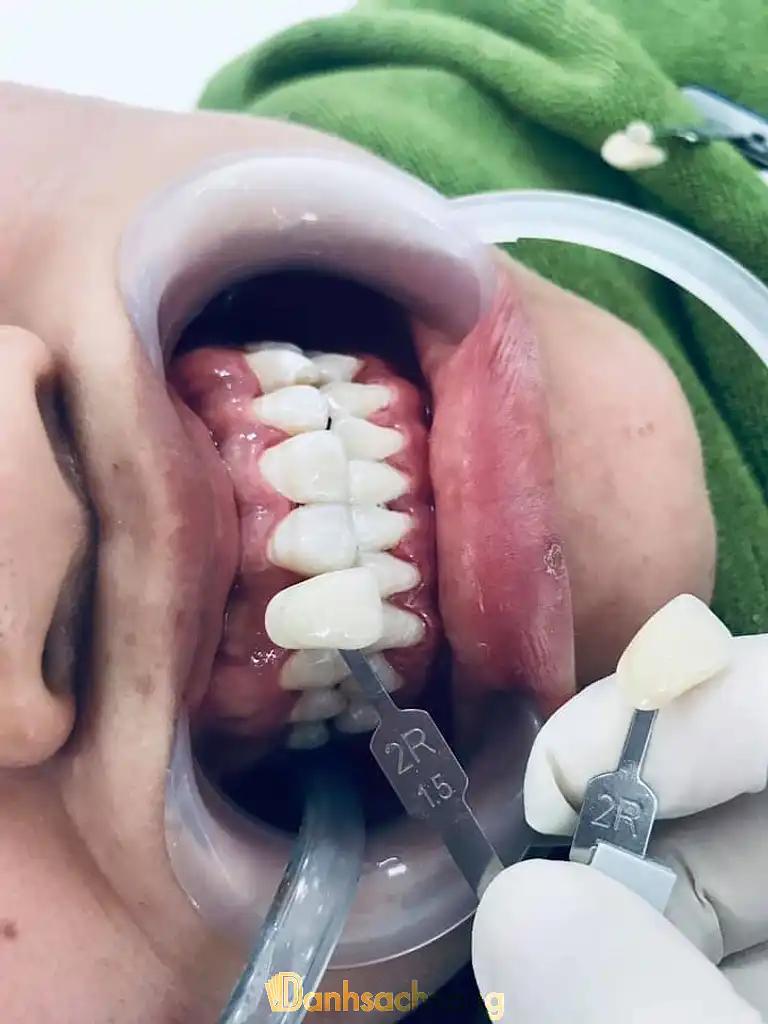 Hình ảnh nha-khoa-chi-dong-to-1-me-linh-5