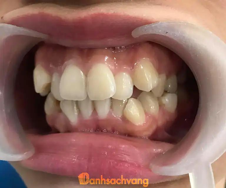 Hình ảnh Nha khoa Trung Châu: 14 Văn Môn, Đan Phượng