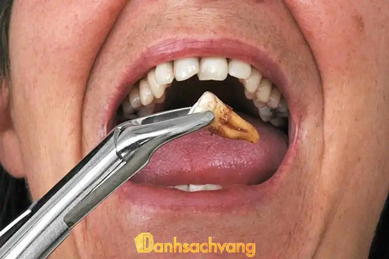 Hình ảnh nha-khoa-minh-anh-355106-xuan-dinh-bac-tu-liem-5