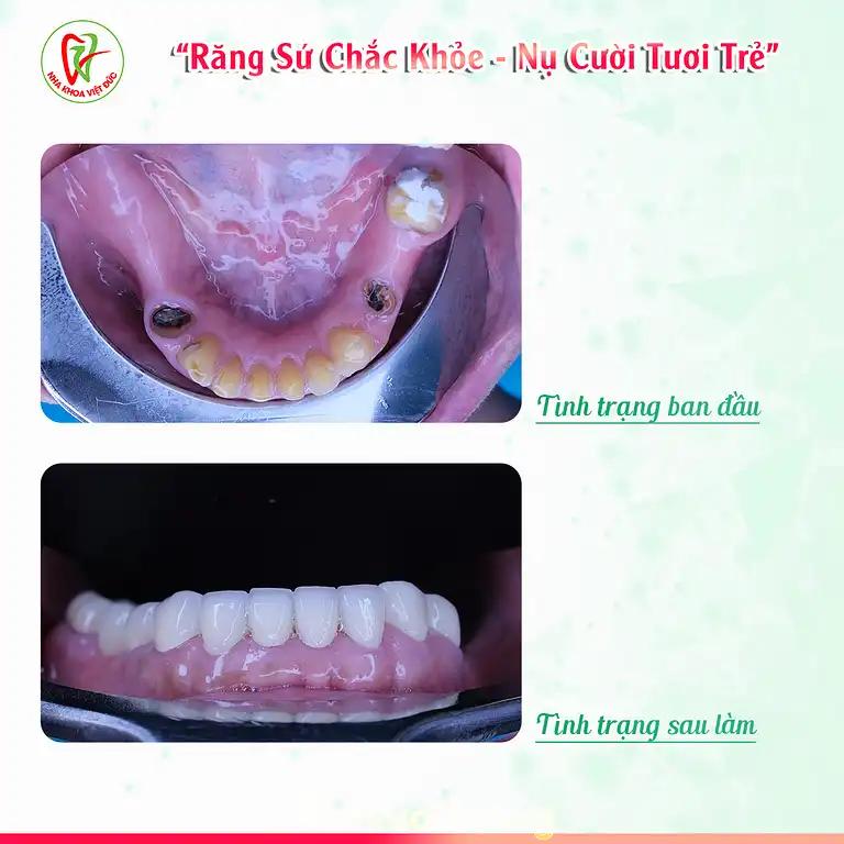 Hình ảnh nha-khoa-viet-duc-92a-yen-bai-hai-chau-2