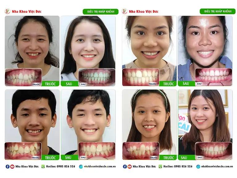 Hình ảnh nha-khoa-viet-duc-92a-yen-bai-hai-chau-5