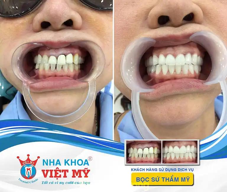 Hình ảnh nha-khoa-viet-my-574-trung-nu-vuong-hai-chau-3