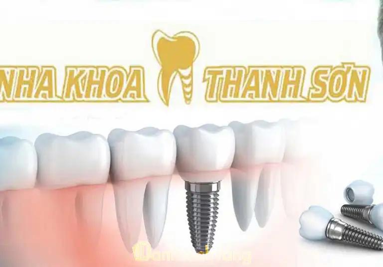 Hình ảnh nha-khoa-thanh-son-390-dong-da-hai-chau-1