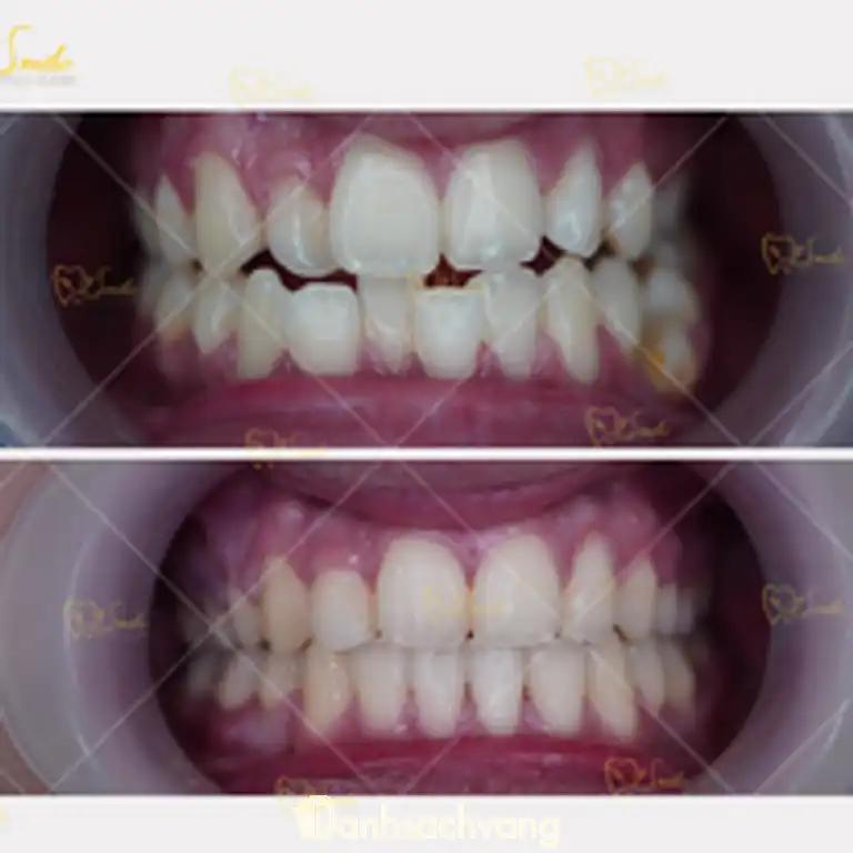 Hình ảnh nha-khoa-my-smile-170-nguyen-van-linh-thanh-khe-4