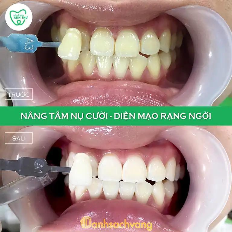 Hình ảnh nha-khoa-anh-thu-351-trung-nu-vuong-hai-chau-5