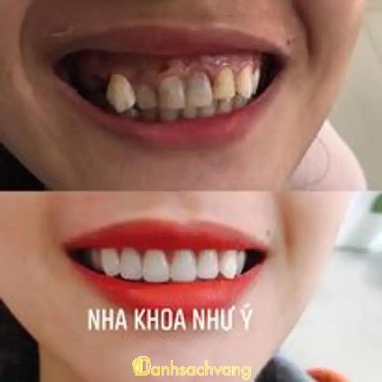 Hình ảnh nha-khoa-nhu-y-325-ha-huy-tap-thanh-khe-4