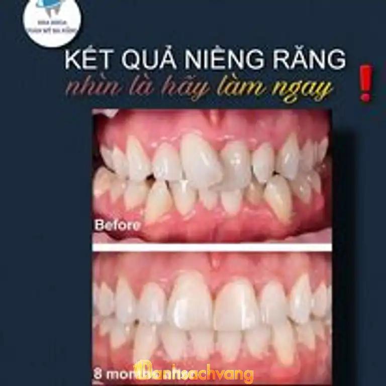 Hình ảnh nha-khoa-toan-my-212-be-van-dan-thanh-khe-3